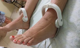 Bioimpedancia Multifrecuencial. Evaluación de líquidos y proteinas